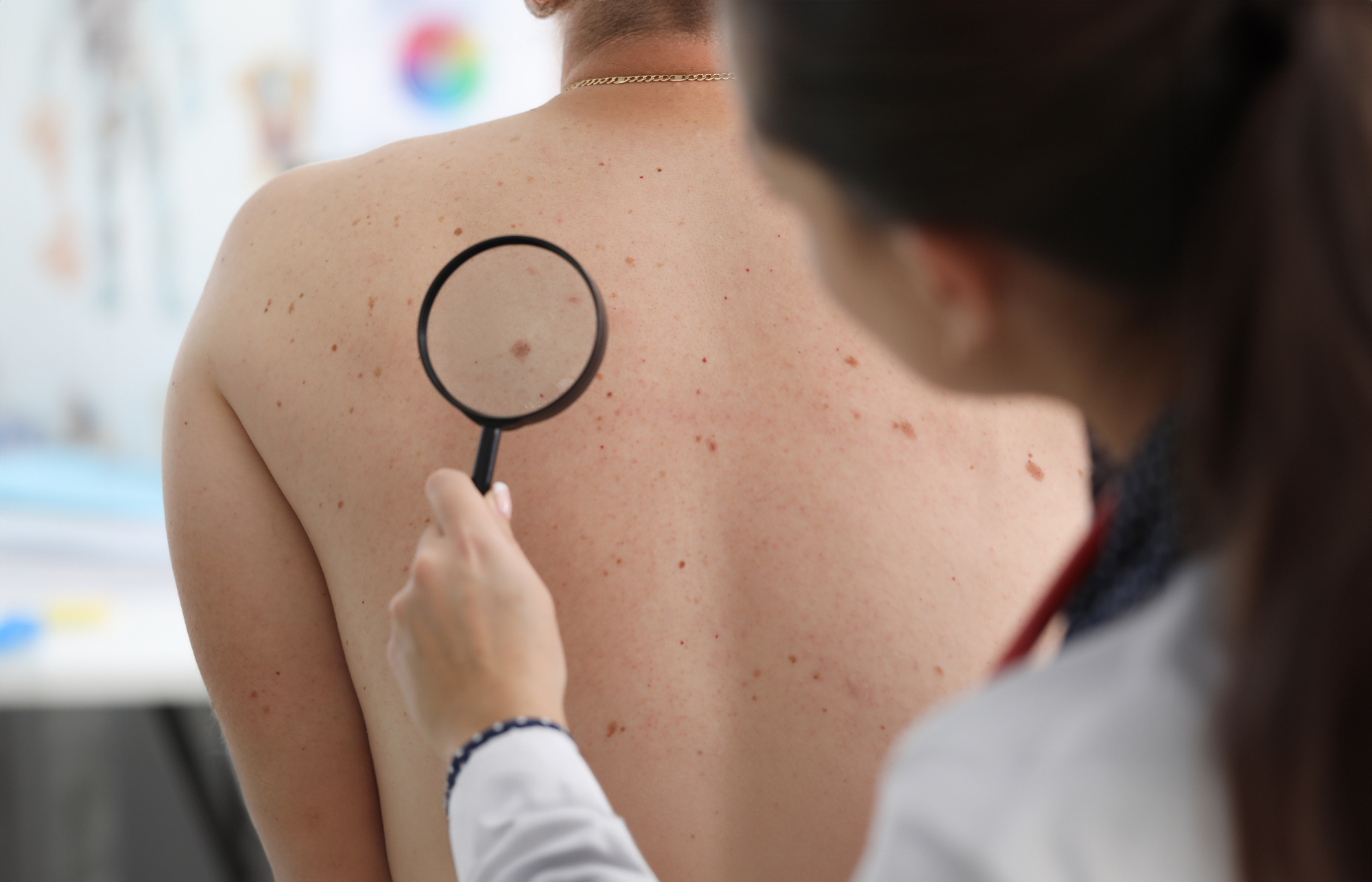Dermatologija ima vedno odgovore